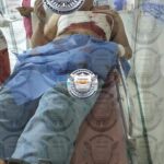 Explosión en la UPTx deja un alumno lesionado