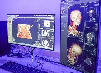 TLAXCALA CONSOLIDA AL ITAES COMO EL CENTRO PÚBLICO DE DIAGNÓSTICO MÁS AVANZADO DE LA REGIÓN